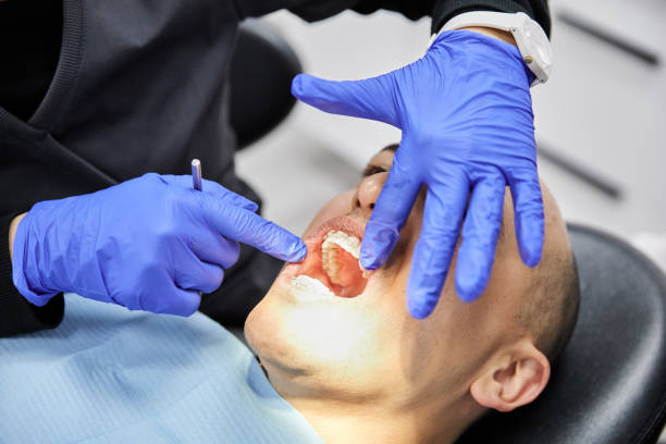Best Emergency Denture Repair in Hawarden, IA